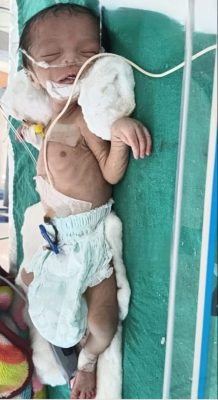 Baby Neha Kumari Baby Neha Kumari